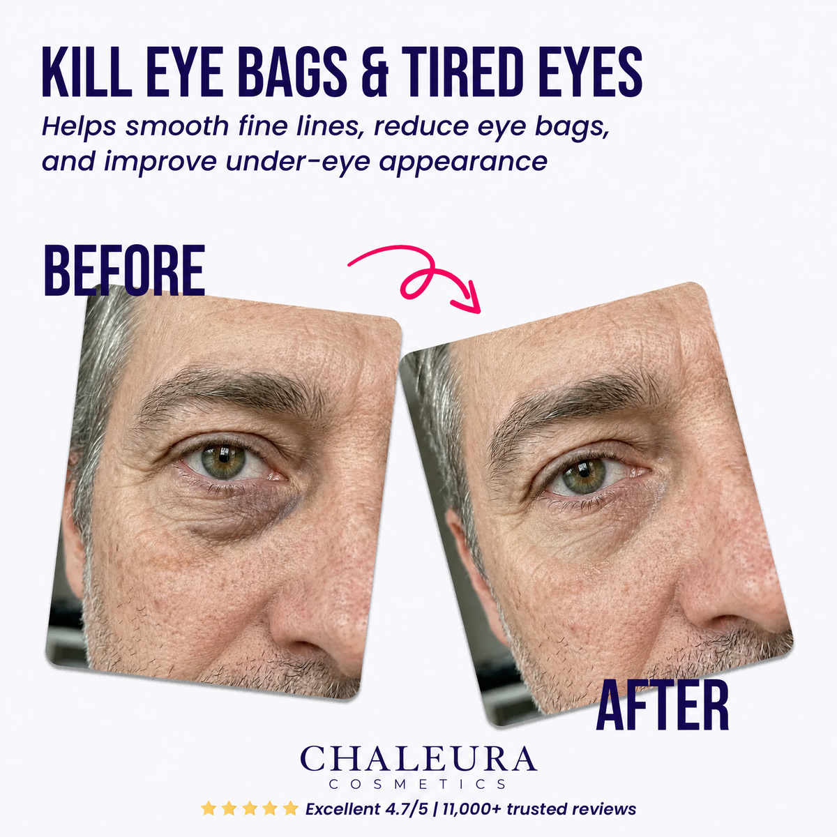 Under-Eye Repair Patches